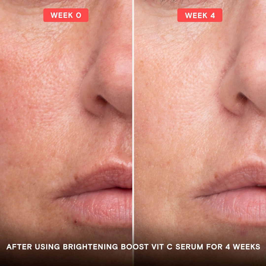 Brightening Boost Vitamin C Power Serum