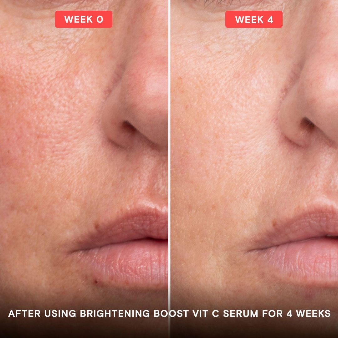 Brightening Boost Vitamin C Pro System