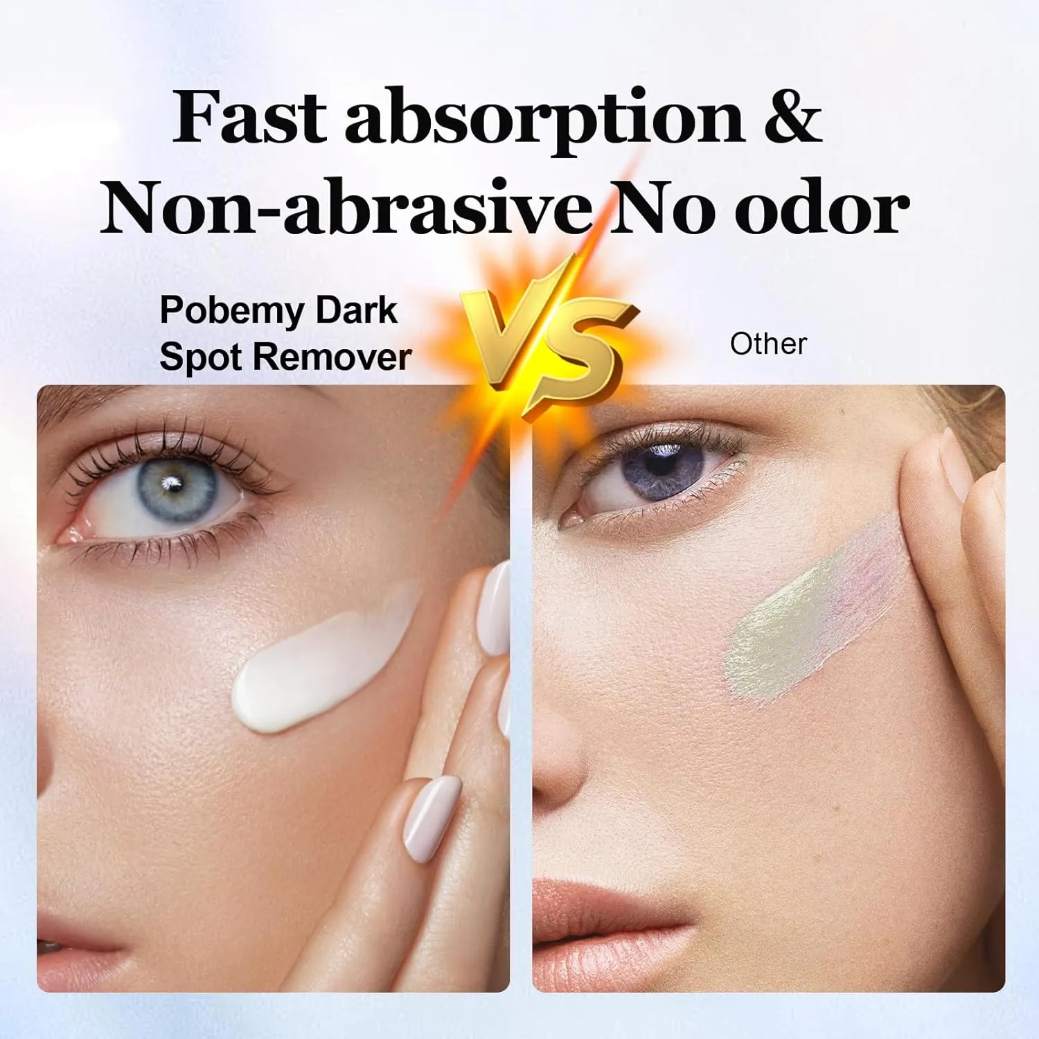 Dark Spot Remover for Face Body, Dark Spot Corrector Cream for Sun Spots, Age Spots, Brown Spots, Melasma Natural Dark Spot Remover Skin Care with Niacinamide Vitamin C for Women (1.0 Fl Oz)