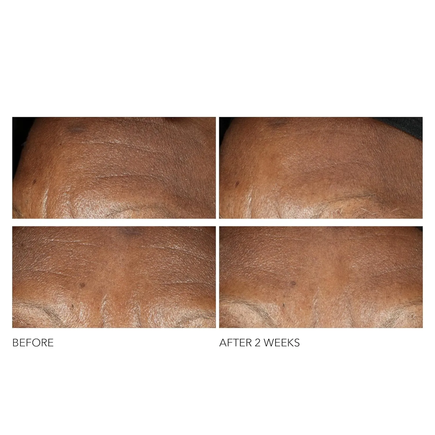 Dr Dennis Gross Advanced Retinol   Ferulic Intense Wrinkle Cream | Intensely Hydrating to Visibly Transform Skin and Repair the Moisture Barrier | 2 oz