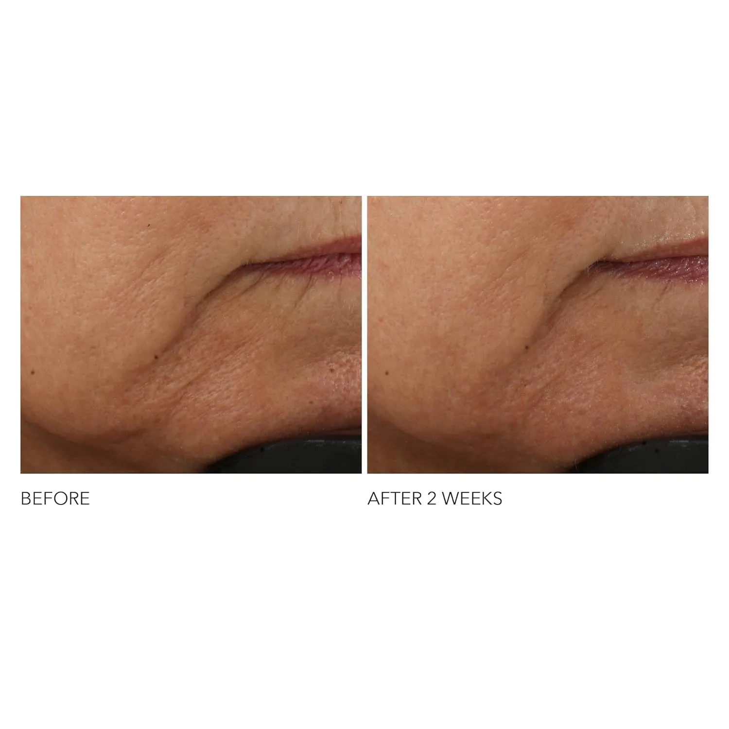 Dr Dennis Gross Advanced Retinol   Ferulic Intense Wrinkle Cream | Intensely Hydrating to Visibly Transform Skin and Repair the Moisture Barrier | 2 oz