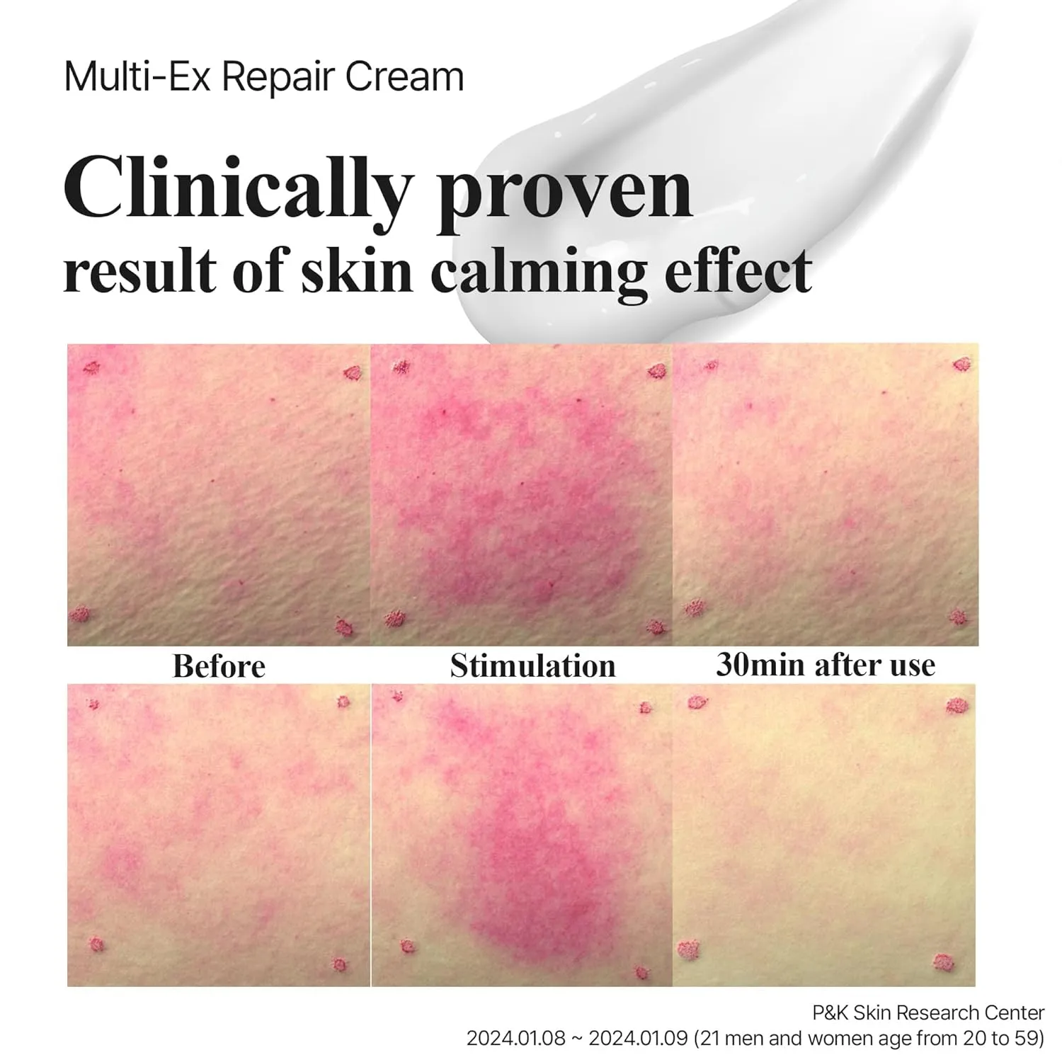 Lab for you] Multi-Ex Repair Cream 50ml/1.69fl.oz | After laser treatment cream | EGF | Soothing Moisturizing Sensitive Skin | Facial Moisturizer | Skin-Relief | Skin Repair Restore