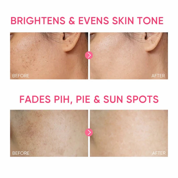MSH Niacinamide Brightening Glowing Moisture Gel 30g