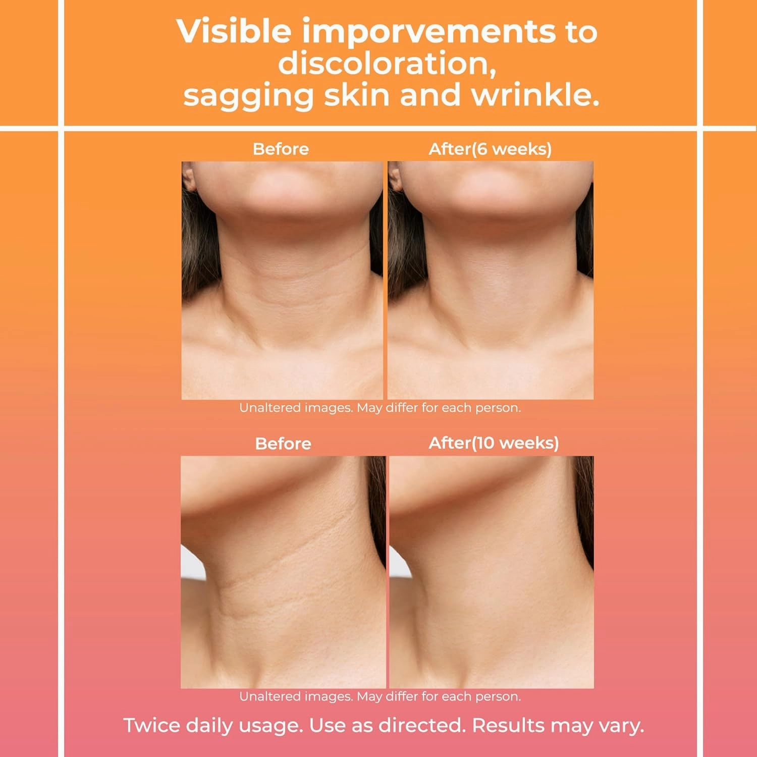 Neck Cream for Tightening and Firming: Anti Aging Anti Wrinkles Reduces Neck Lines Fine Lines - Retinol Niacinamide Squalane Hyaluronic Acid Ceramides Cruelty Free Paraben Free 2.7 OZ/80g