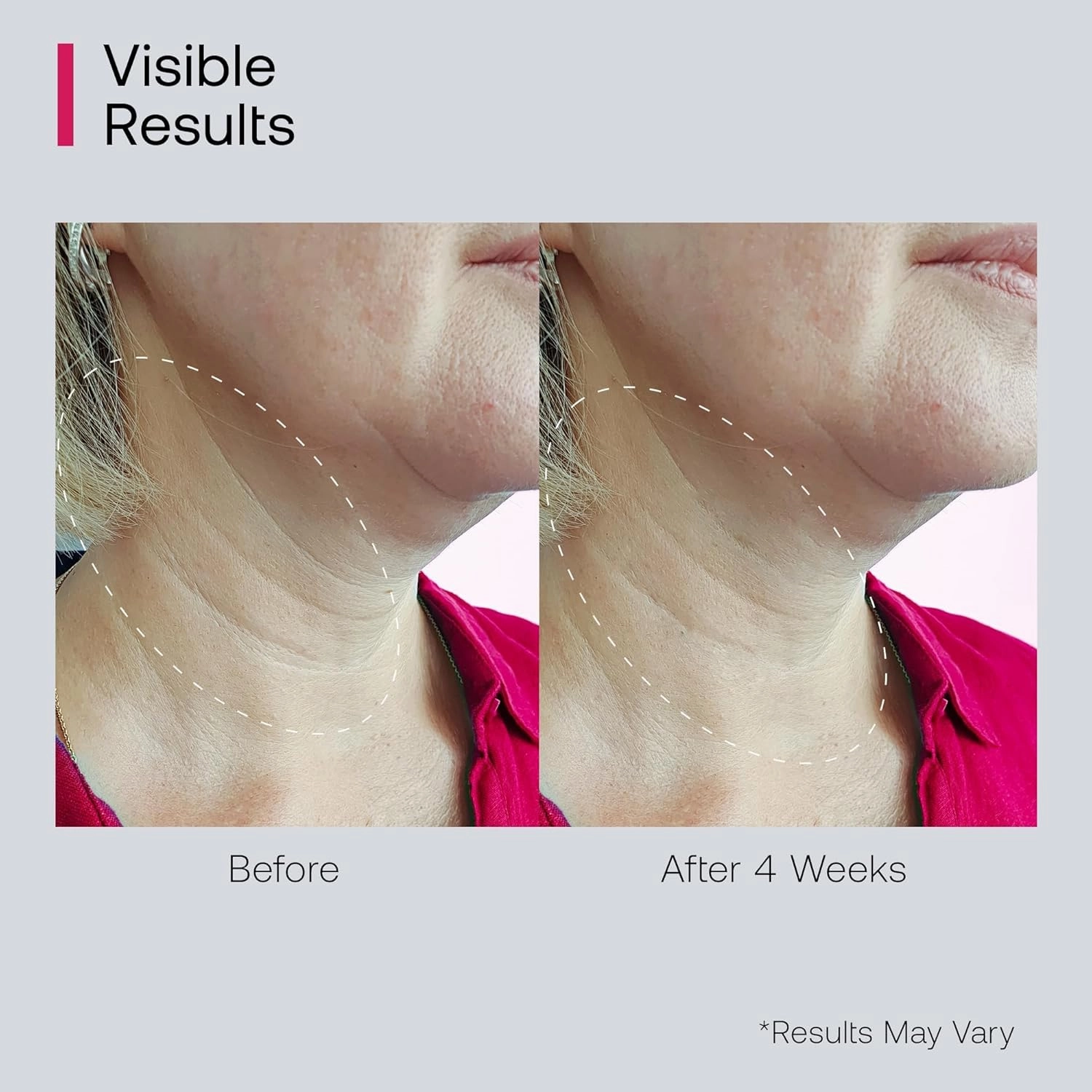 Neck Cream for Tightening and Firming: Anti Aging Anti Wrinkles Reduces Neck Lines Fine Lines with Roller Applicator - Retinol Niacinamide Hyaluronic Acid Cruelty Free Paraben Free 1.7 OZ/50g