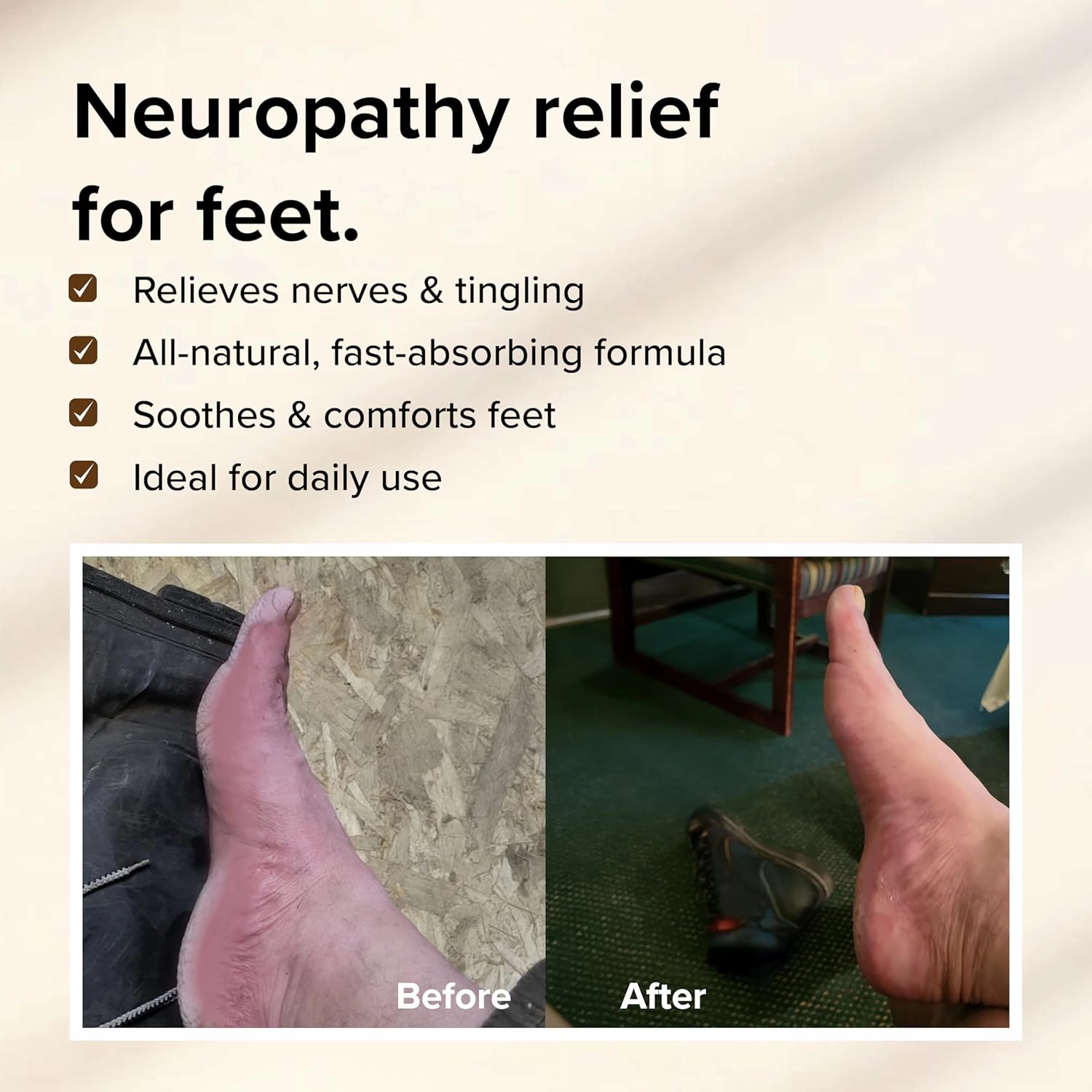Neuropathy Support Cream for Feet – ALL-NATURAL Shea Butter & Aloe Vera with Spikenard, Hyssop, Cassia & Cinnamon – Helps Tingling & Burning Nerves (2oz)
