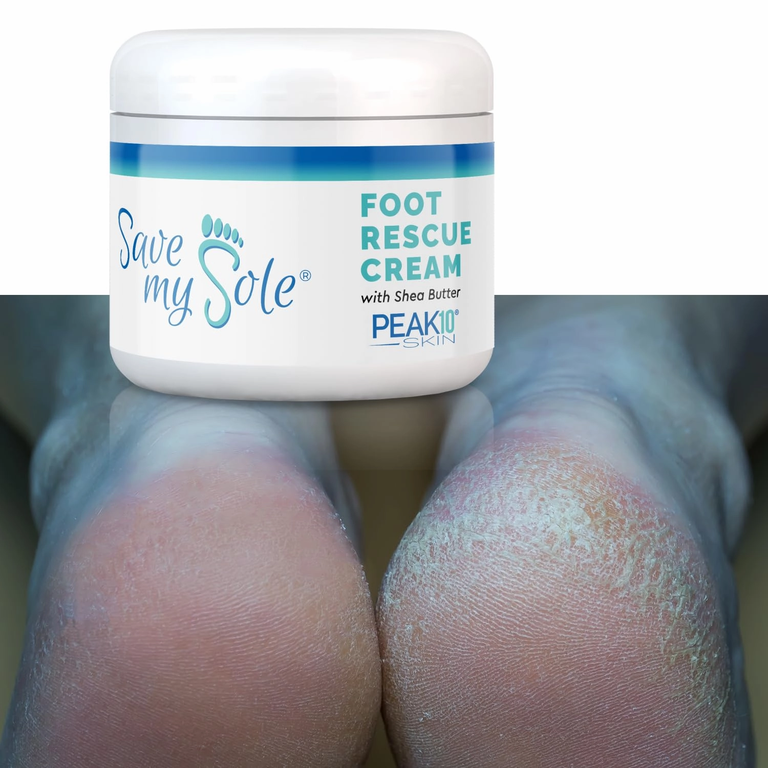 SAVE MY SOLE foot rescue cream 4oz