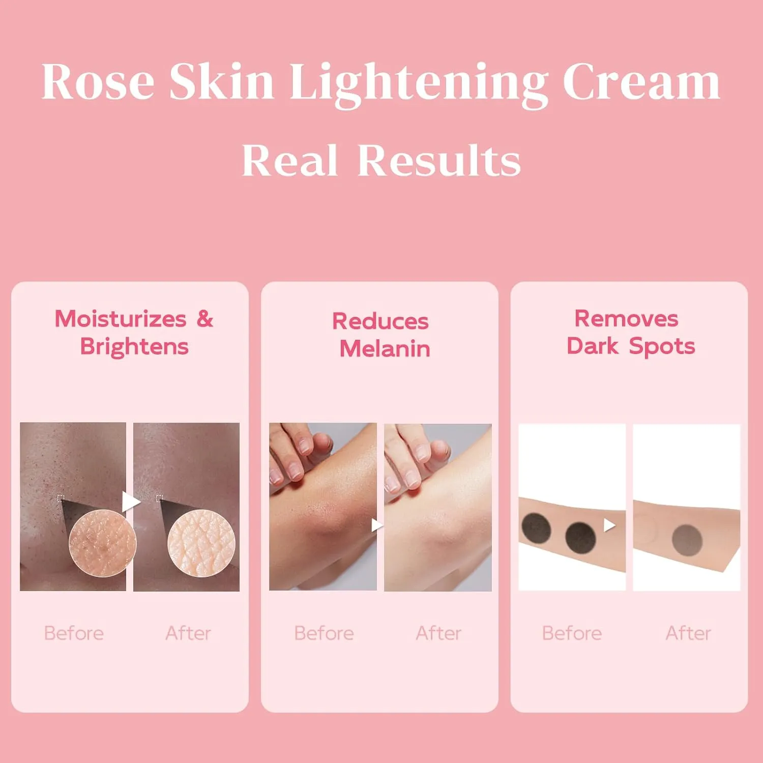 Skin Lightening Cream - Underarm Lightening, Dark Elbows and Knees, Armpit, Intimate Areas, Inner Thigh, Bikini Areas, Private Parts, 1.69 fl.oz