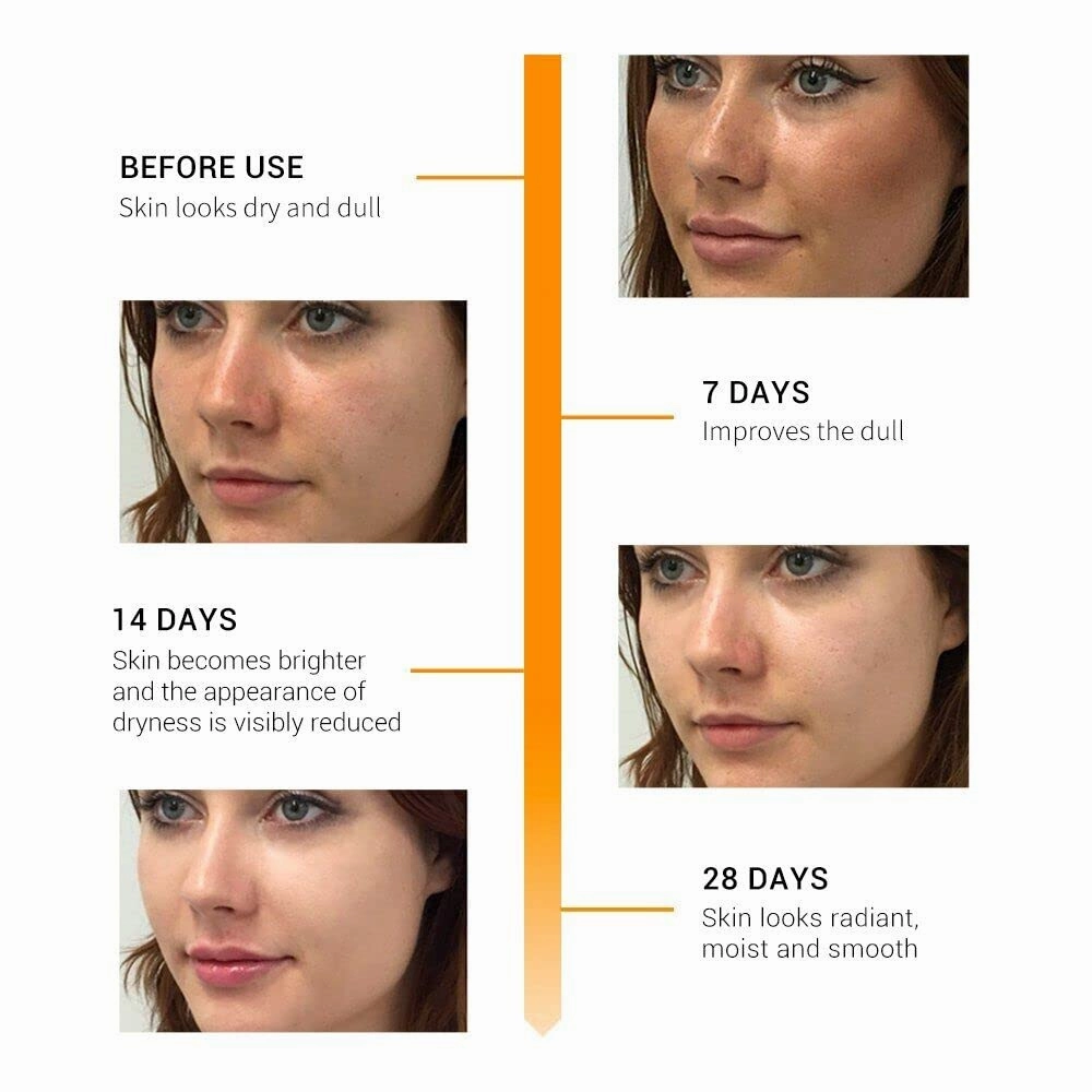 Vitamin C   Retinol Anti-Aging Serum Gel-Cream – Brightening, Wrinkle Defense, Fine Line Reduction – 1oz Skin Firming & Hydrating Formula for Face – Collagen Booster for Radiant Skin