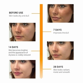 Vitamin C   Retinol Anti-Aging Serum Gel-Cream – Brightening, Wrinkle Defense, Fine Line Reduction – 1oz Skin Firming & Hydrating Formula for Face – Collagen Booster for Radiant Skin